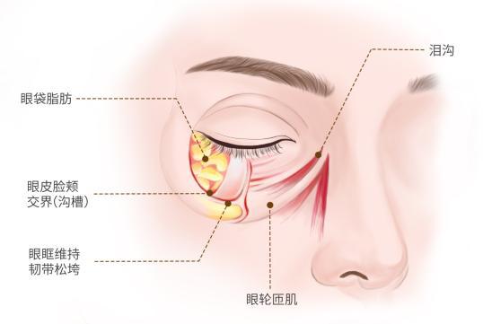 衰老的标志去除眼袋焕发青春光彩ayx爱游戏app眼袋不是自然