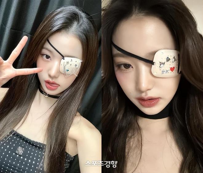 健康状况引担忧密集行程下仍坚持完美表现AYX爱游戏APP韩国知名女星张元英